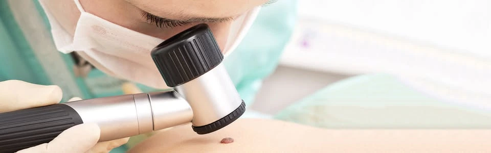 Mole Check Clinic